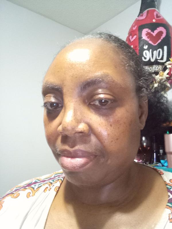 Customer photo for "Skin care"