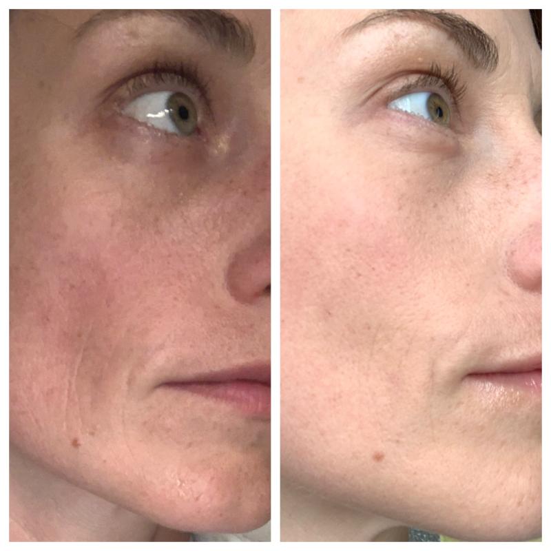 Left photo - before use/Right photo - 3 weeks after use