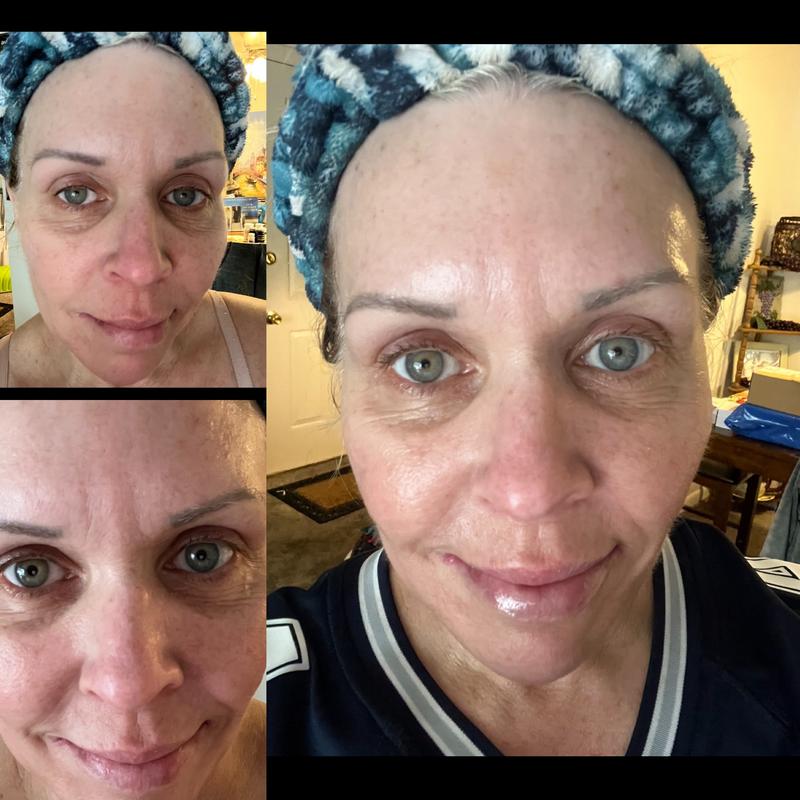 Customer photo for "Plump and shine"