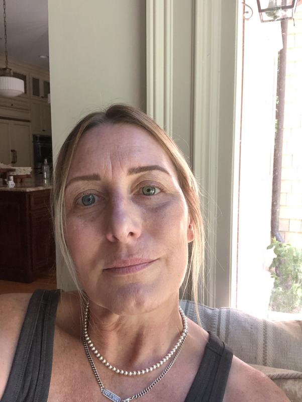 Customer photo for "Skin saver!!!"
