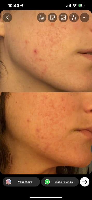 Review Thumbnail Image 0 243099483