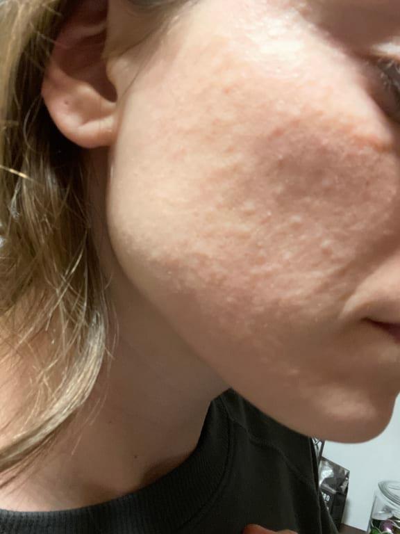 Customer photo for "Made me breakout in a rash"