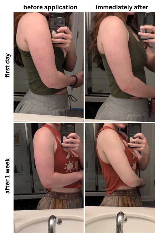 Customer photo for "Great for treating Keratosis Polaris"