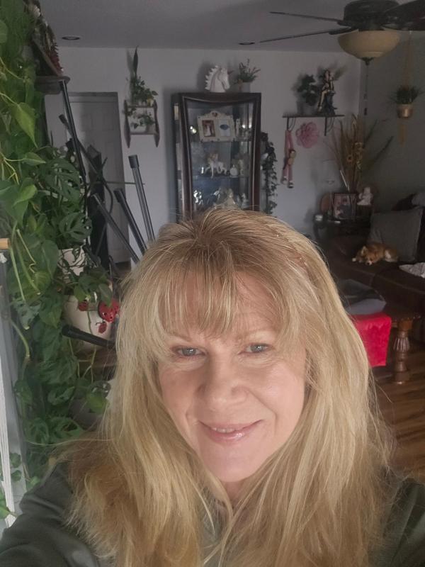 Customer photo for "Love, love, love this product, I'm 62 when I started going through menopause, I lost all the elasticity in my skin."
