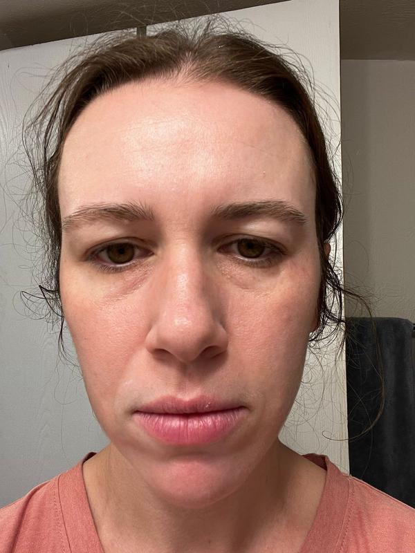 Customer photo for "Instant glow"