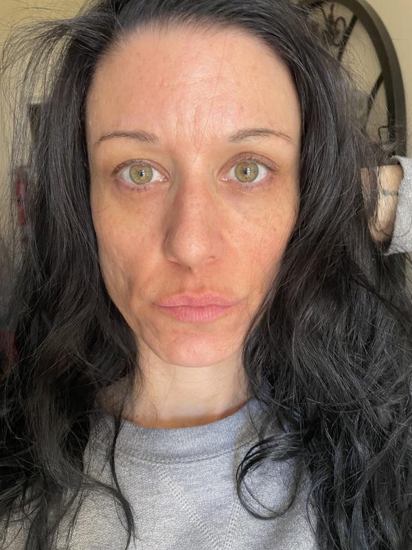 Mudmasky® Pre + Probiotic Facial Mask