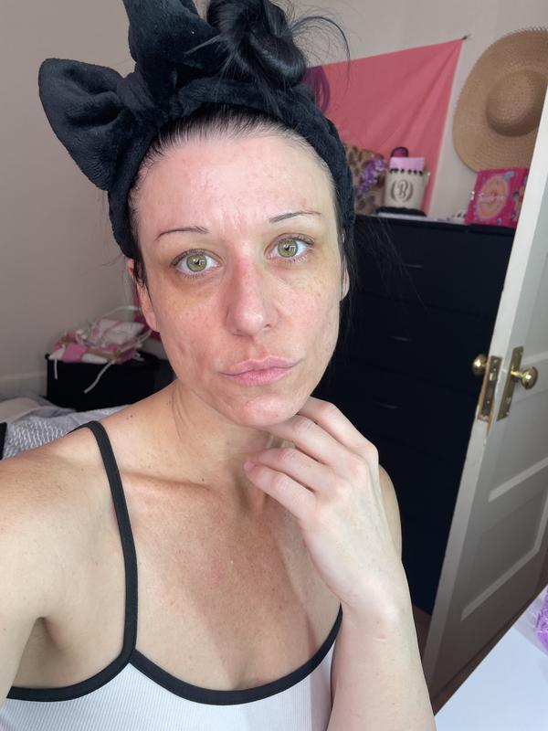 Mudmasky® Pre + Probiotic Facial Mask