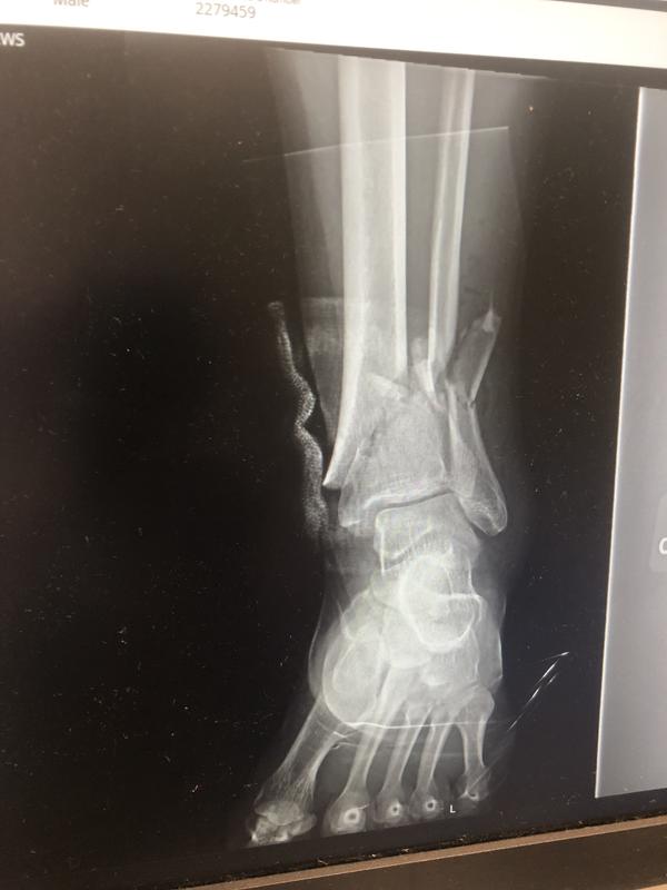 Photo submitted with review of product