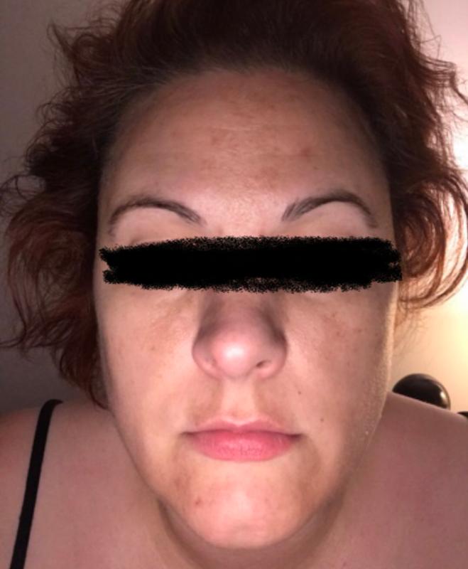 Before applying product!