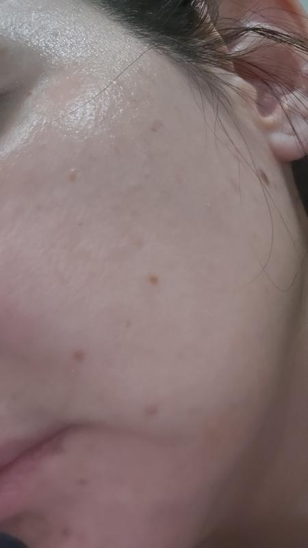 Very dry patchy skin