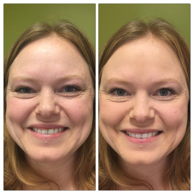 Left: Before CC+ Airbrush, with only moisturizer and mascara. Right: After CC+ Airbrush.