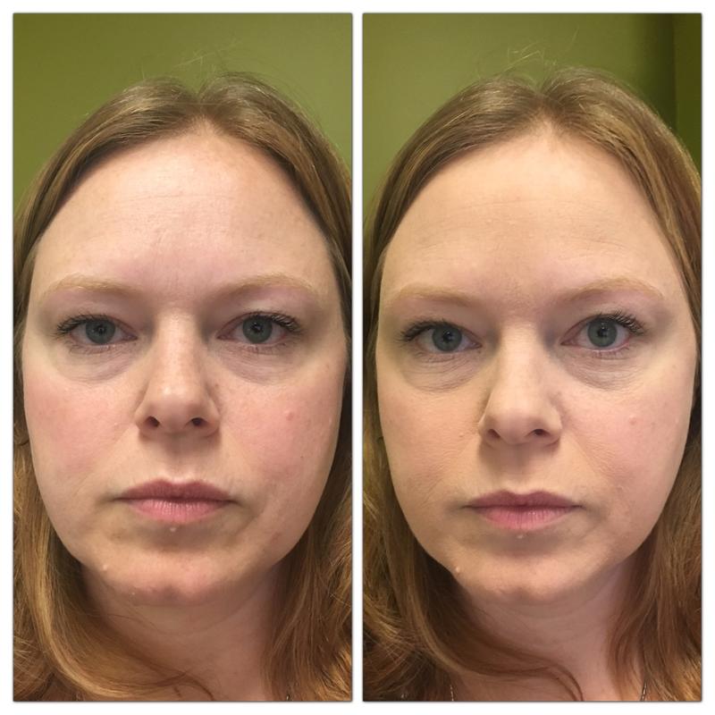 Left: Before CC+ Airbrush, with only moisturizer and mascara. Right: After CC+ Airbrush.