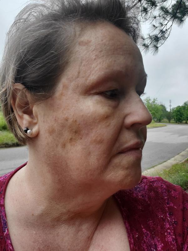 Shade light and how it oxidized