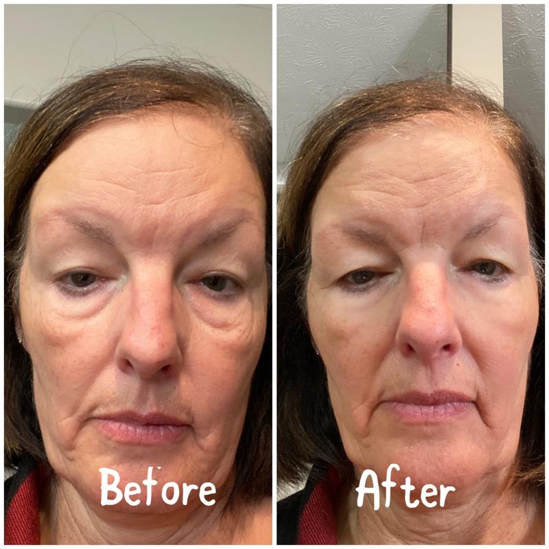 Before & After