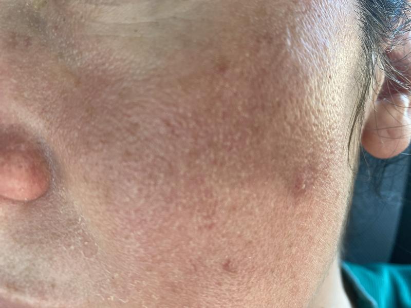 It was never so dry and patchy!