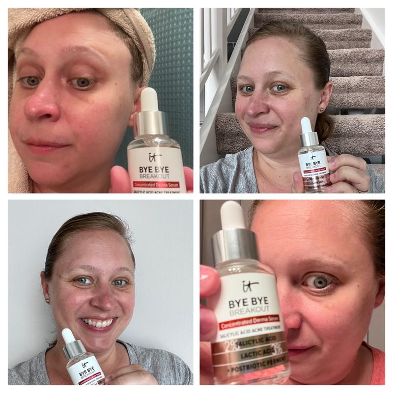 Brake out to brake out free