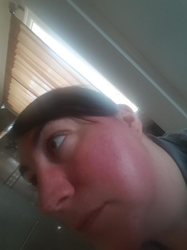 Before - some redness