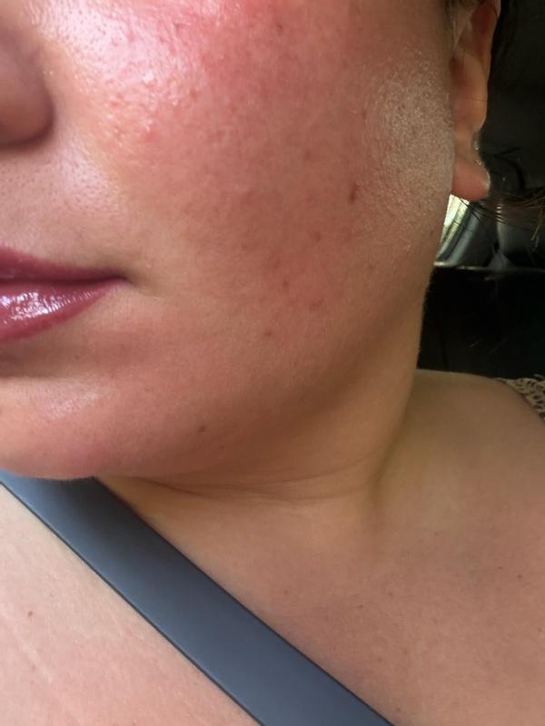 Customer photo for "No cast and wears naturally under makeup"