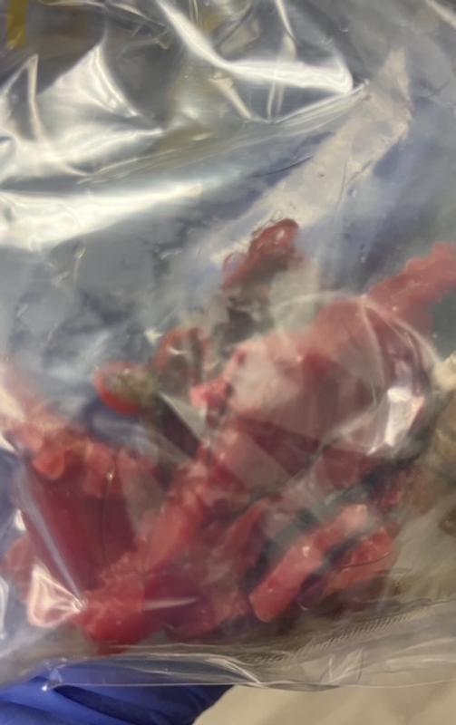 Pieces of the ball from her stomach