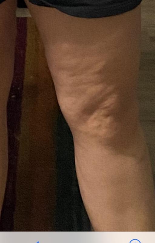 After Jlo booty balm