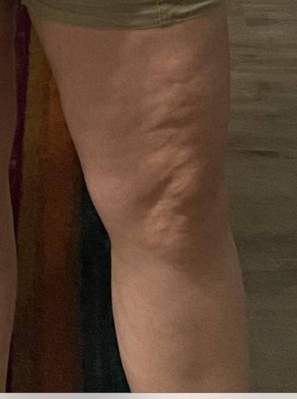 Before Jlo booty balm