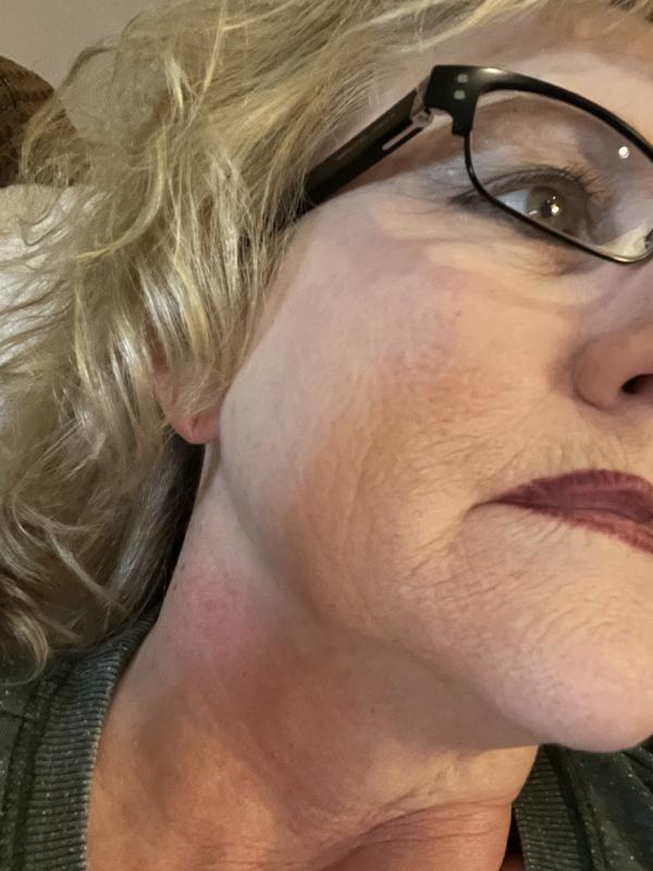 My pores are really cleared up!