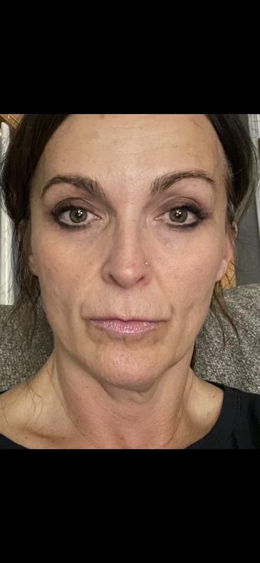 54 yearl old. Loving my skin