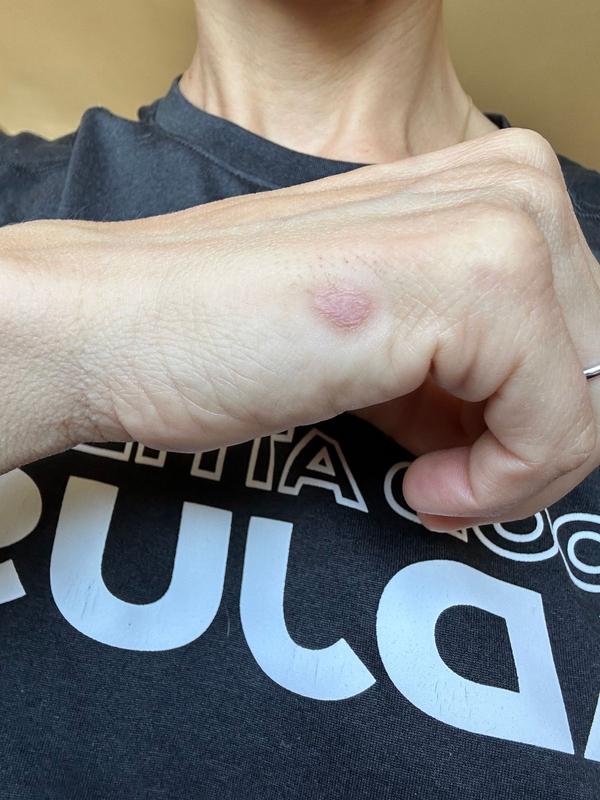 Review Thumbnail Image 0 382867539