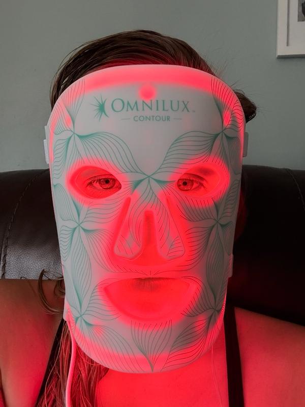 Customer photo for "Improved fine lines and wrinkles"