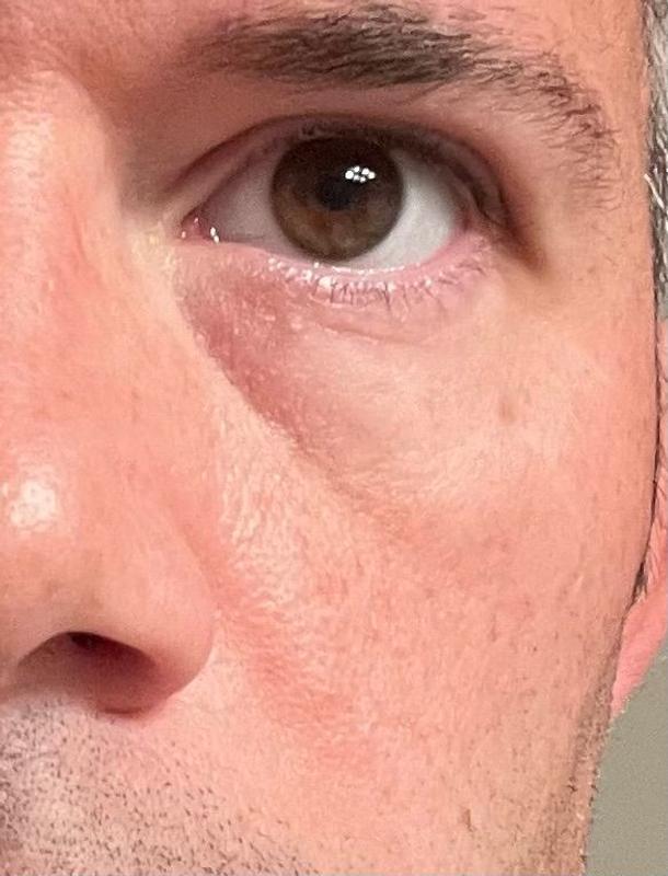 Customer photo for "Shocked by the results after just 7 uses ..."