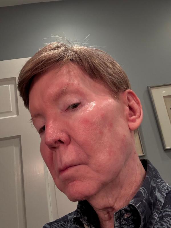 Customer photo for "youthful skin"