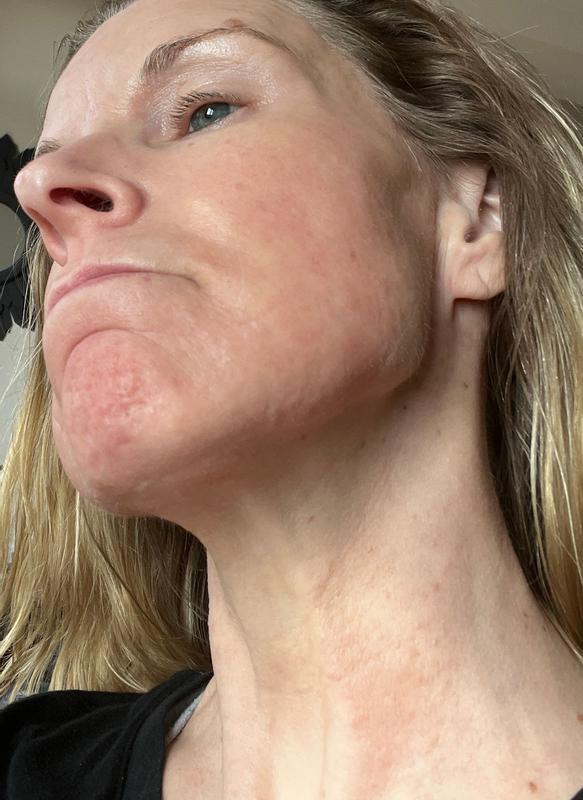 Review Thumbnail Image 1 360180448