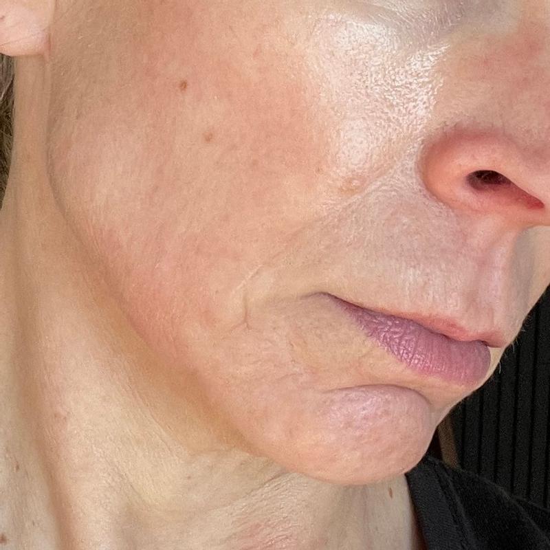 Review Thumbnail Image 2 360180448