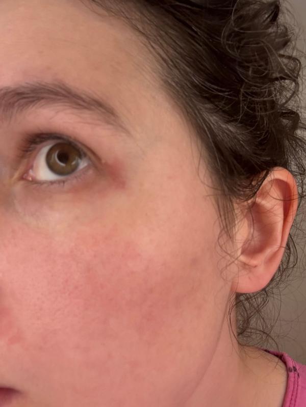 Customer photo for "Do not reccomend for sensitive"