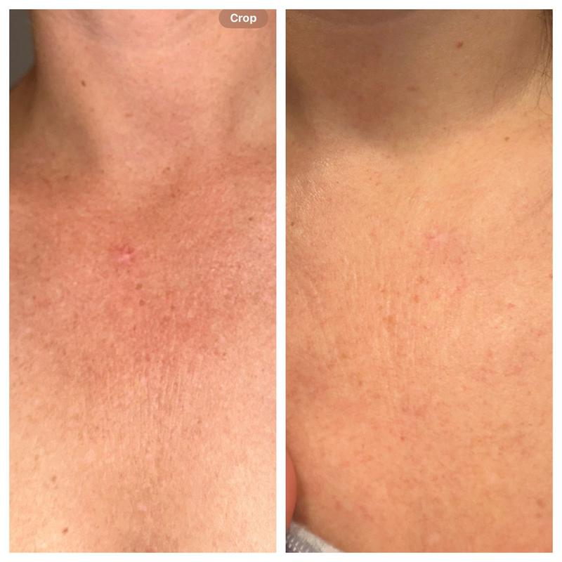 Review Thumbnail Image 0 377789076