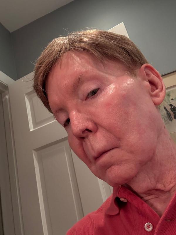 Customer photo for "youthful skin"