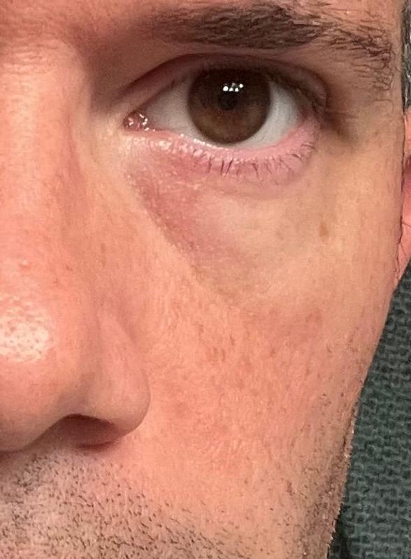 Customer photo for "Shocked by the results after just 7 uses ..."