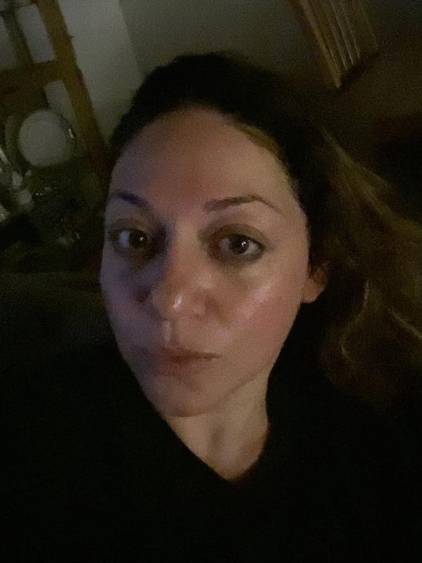 Customer photo for "Best my skin has looked in years!"