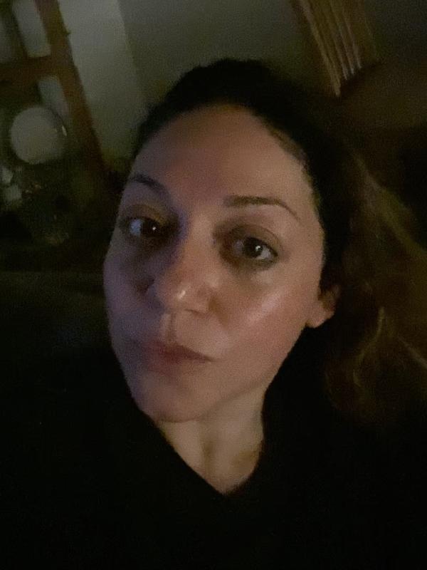 Customer photo for "Best my skin has looked in years!"