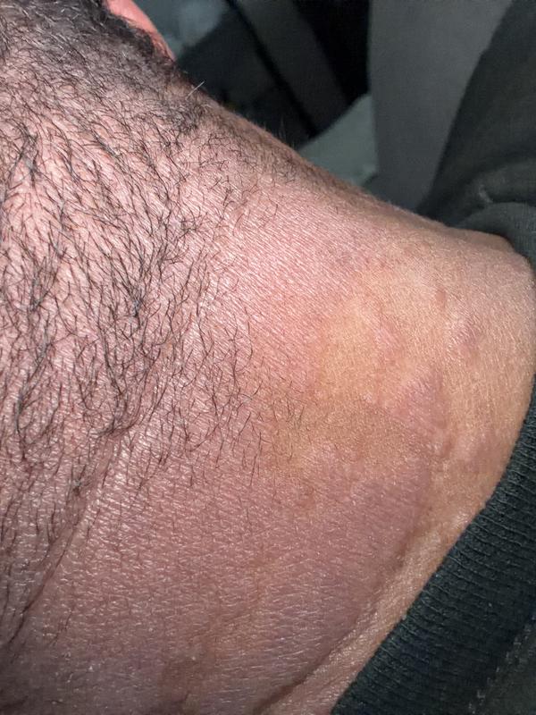 My skin