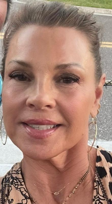 Customer photo for "Hyaluronic Acid"