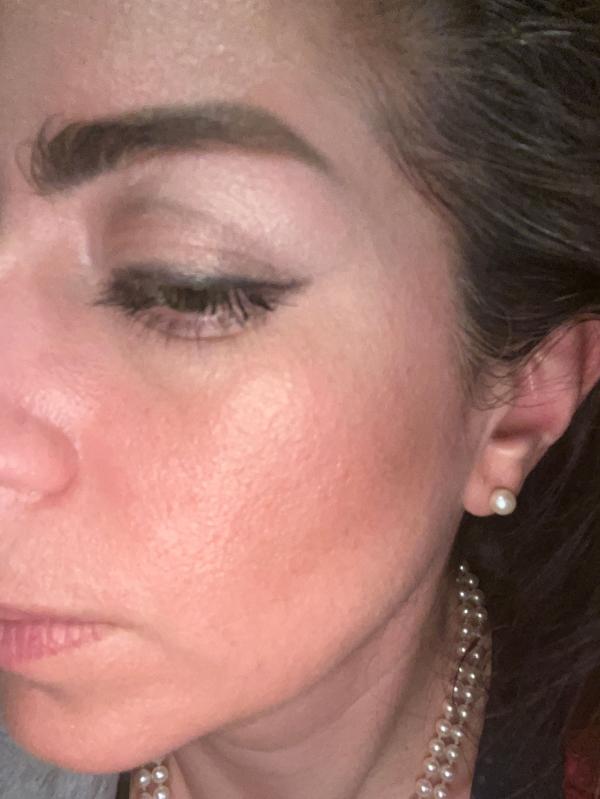 Customer photo for "Helps reduce redness"
