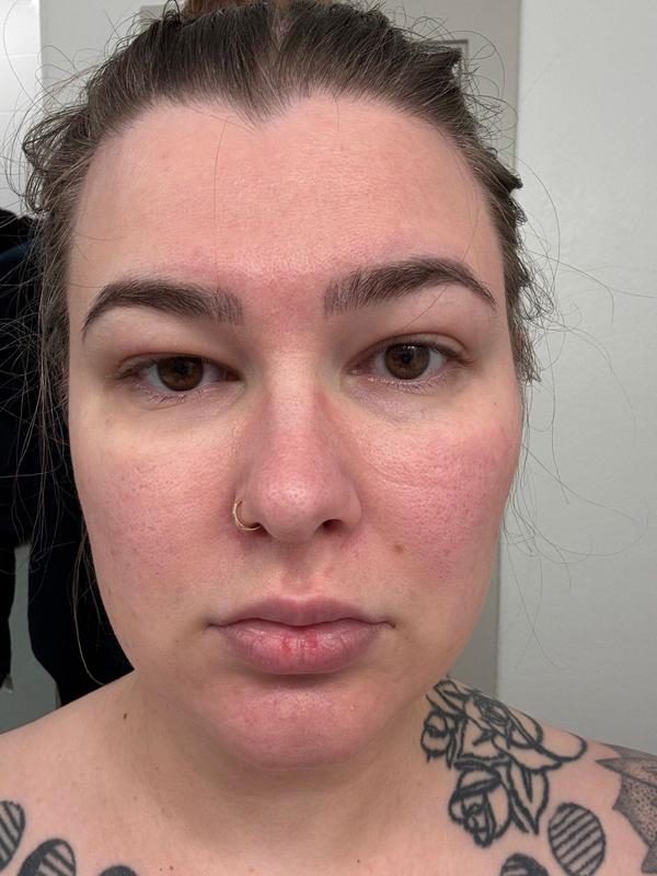 Customer photo for "Gentle yet effective"