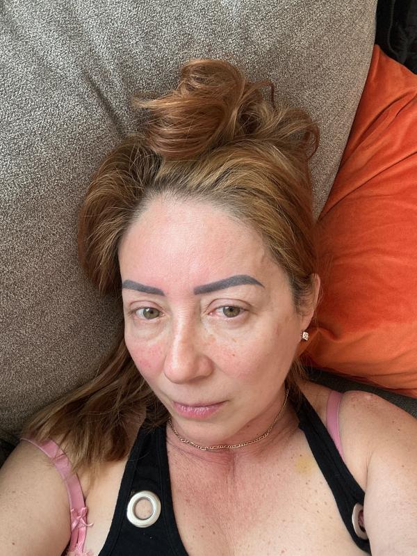 Customer photo for "Hialuronic acid"