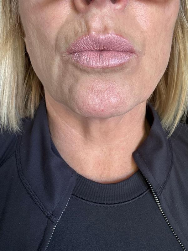 Review Thumbnail Image 0 381992693