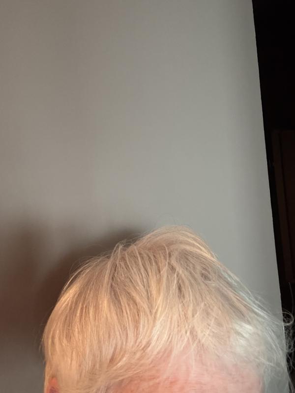 Yikes, wasn’t expecting I had to include photo. Next time more. Note shine, improving