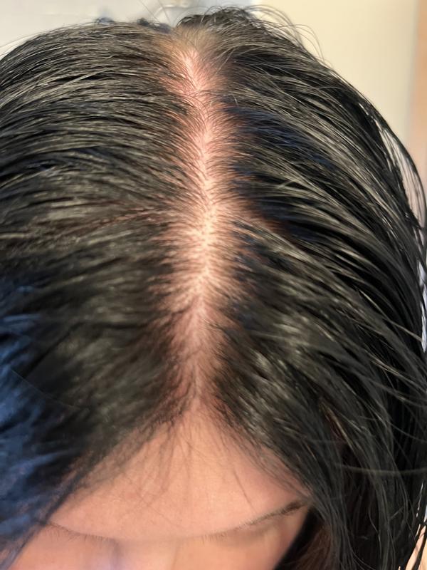 Healing Volume Zero Weight Gel | L'ANZA