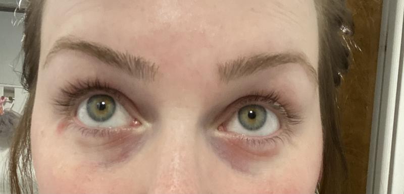 olay retinol eye cream before and after