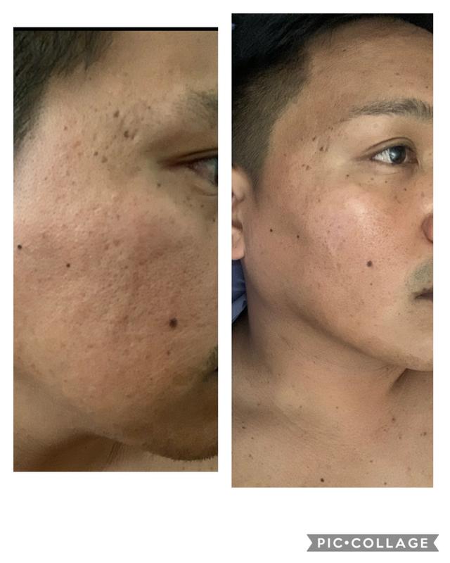 Olay® 1.3 oz. Tone Perfection Serum with Vitamin C and Vitamin B3 harmon