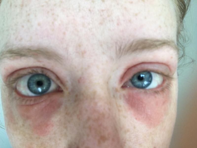 ole henriksen dark circles